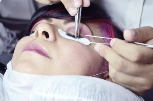 美容家が推奨するニキビケアに最適なサプリは？