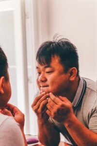 亜鉛を使った女性のニキビ改善方法とは？